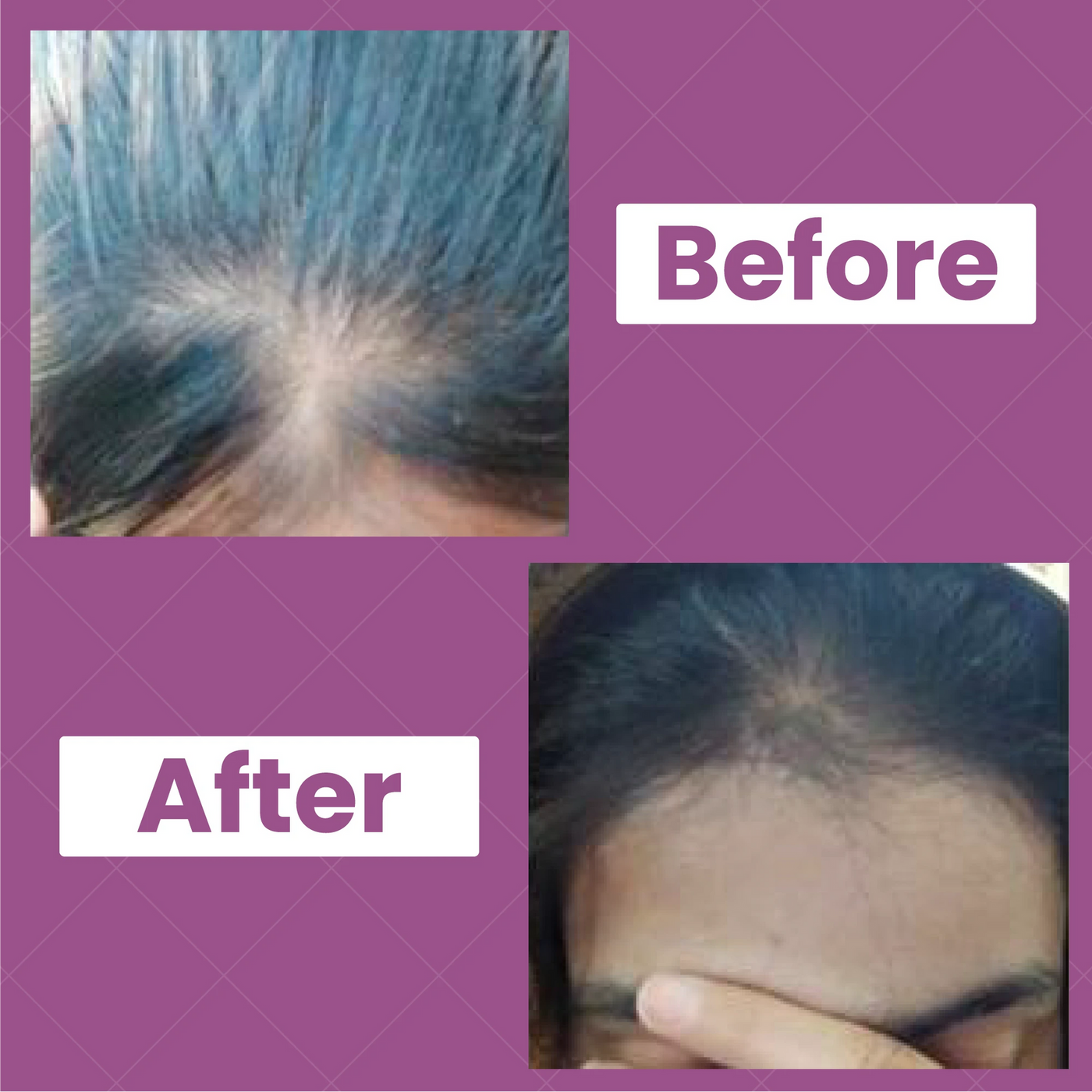 Hair Biotin Oil | Best Hair Oil For All Hair Related Problems|أفضل زيت للشعر لجميع مشاكل الشعر